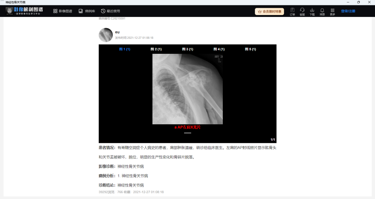 影像解剖图谱32位